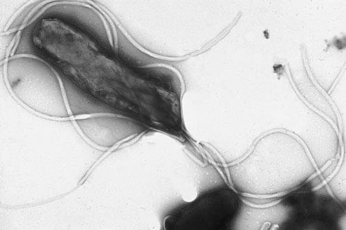 Бактерия Helicobacter pylori. Фото
